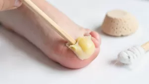 how to remove corn after using corn cap