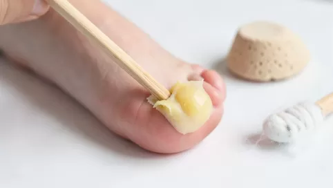 how to remove corn after using corn cap